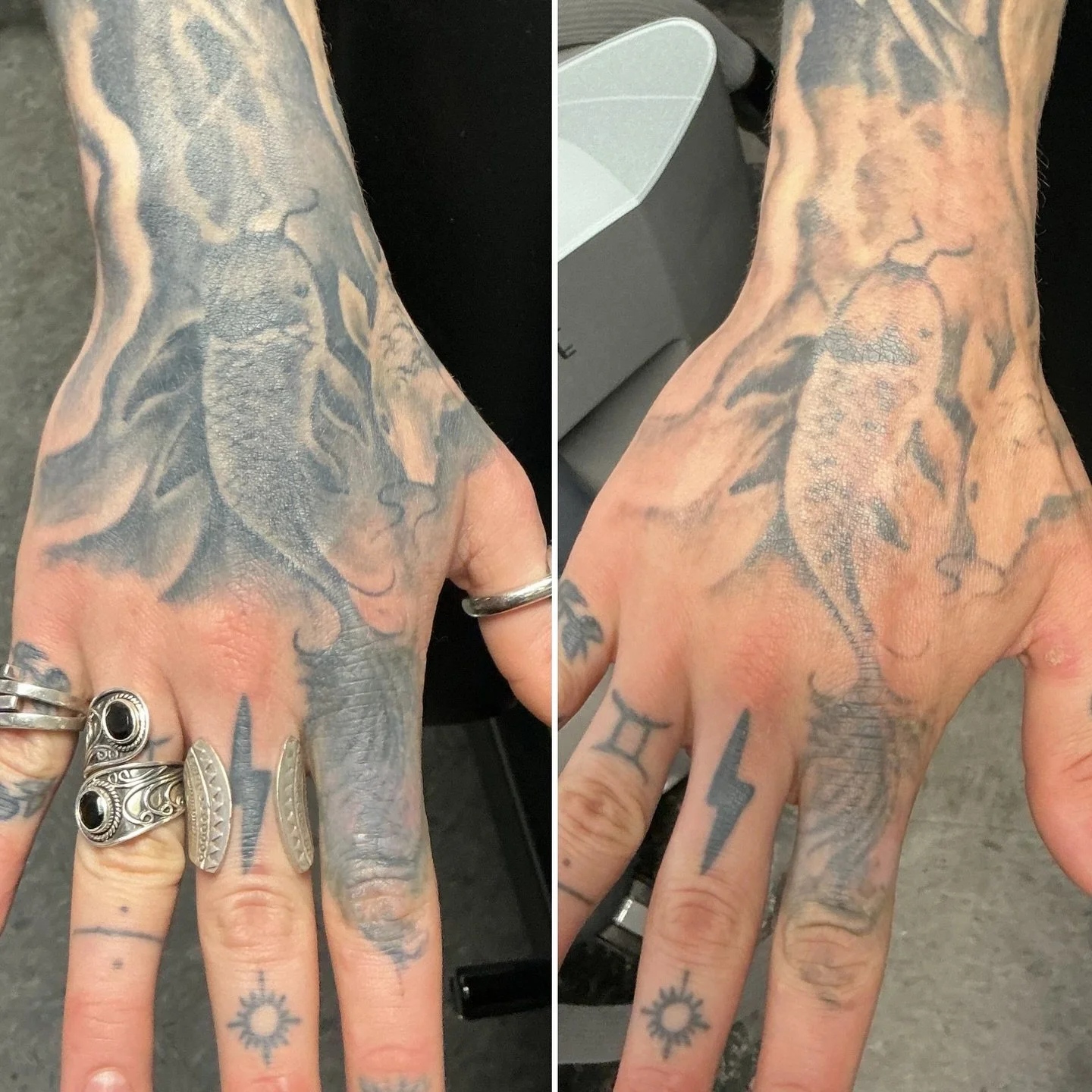 🐠🐠January >>> May 🐠🐠
✨3 treatments on the fish✨
.
.
.
.
.
@lutronic_us 
#lasertattooremoval #lasertattooremovalspecialist #tattooremoval #pittsburgh #tattoo