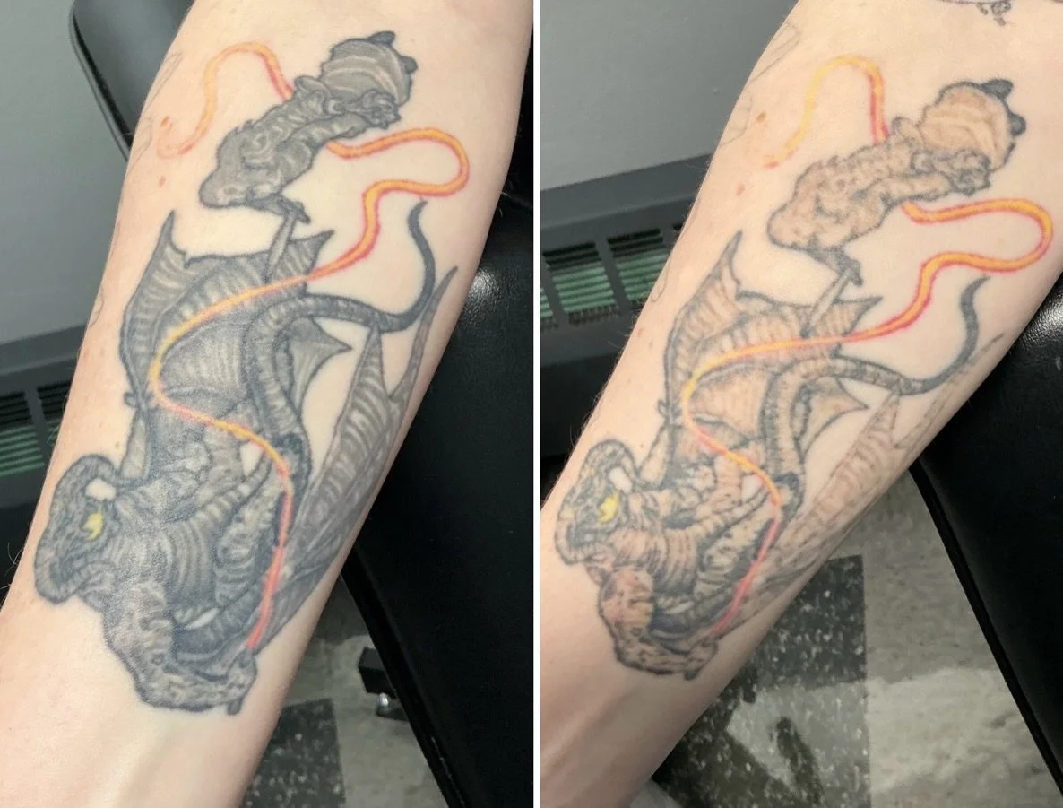 Fading from 1st treatment! Working towards coverup with @mckelveyart ⚡️
.
.
.
.
.
@lutronic 
#lasertattooremoval #tattooremovalspecialists #tattooremoval #pittsburgh #tattoo