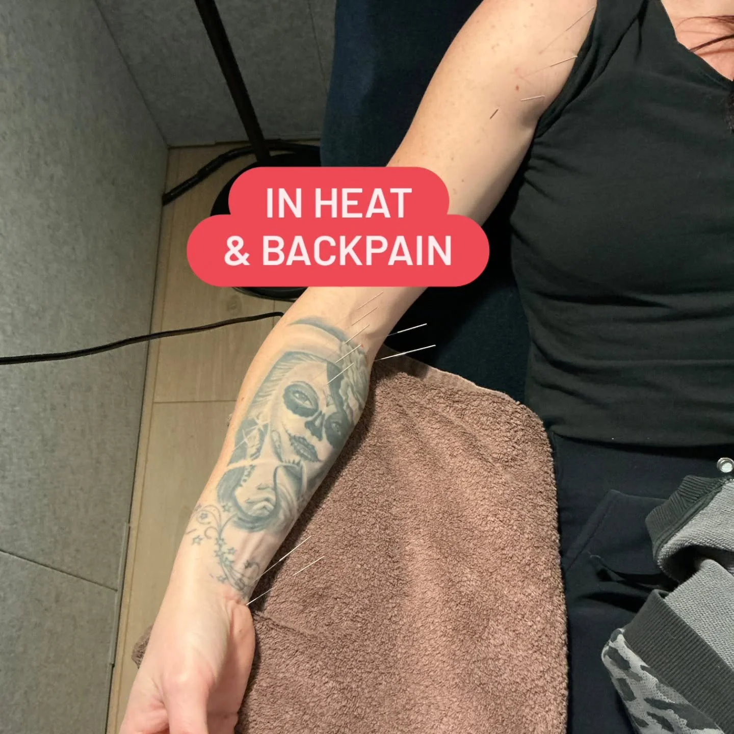 Needling of Jue yin Shao yang for anger, 4 mm in heat for agitated disturbed sleep and LU meridian for UB BACKPAIN.

Follow us for more balance method info! @drtanbalancemethod

#drtan #acupuncture #balancemethodacupuncture