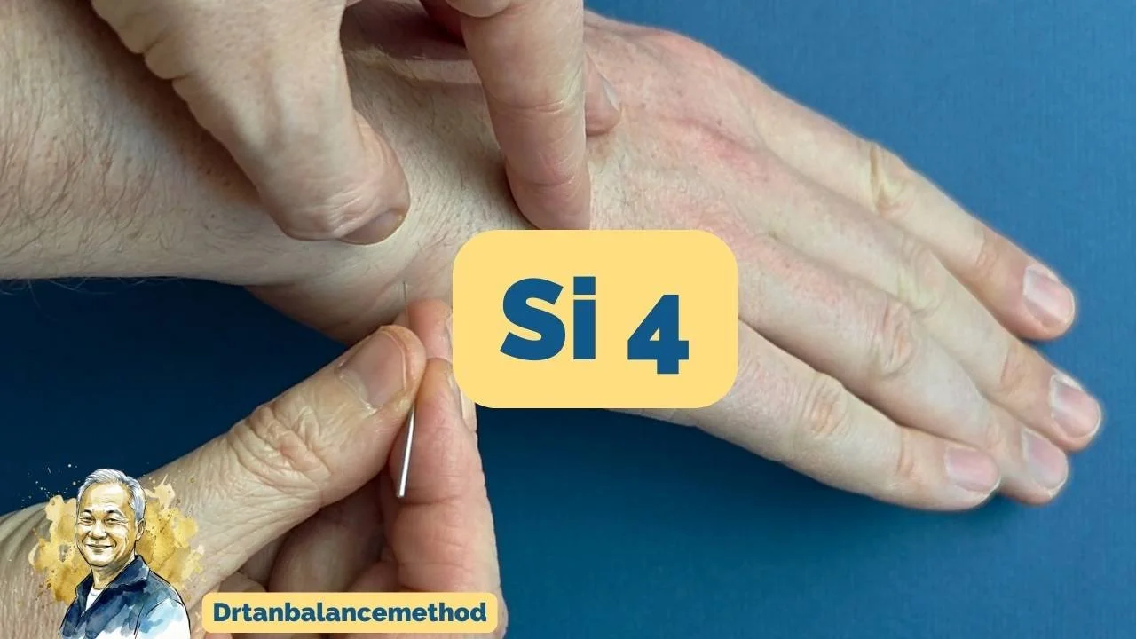 Small Intestine 4 (SI-4) | Balance Method Needling Demo