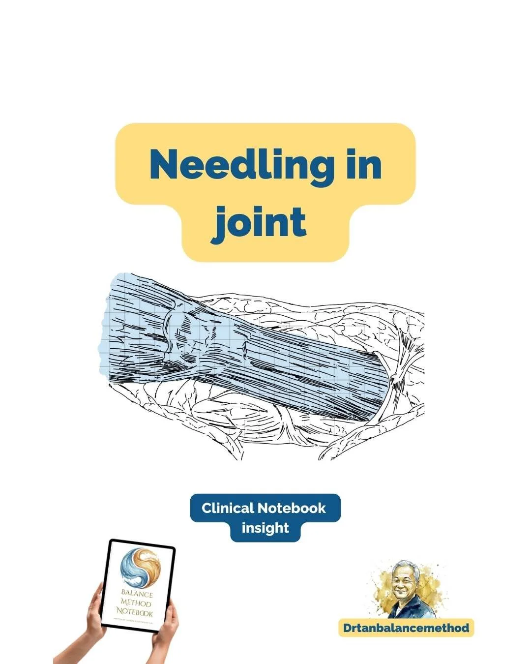 dr tan balance method needling joint.jpg