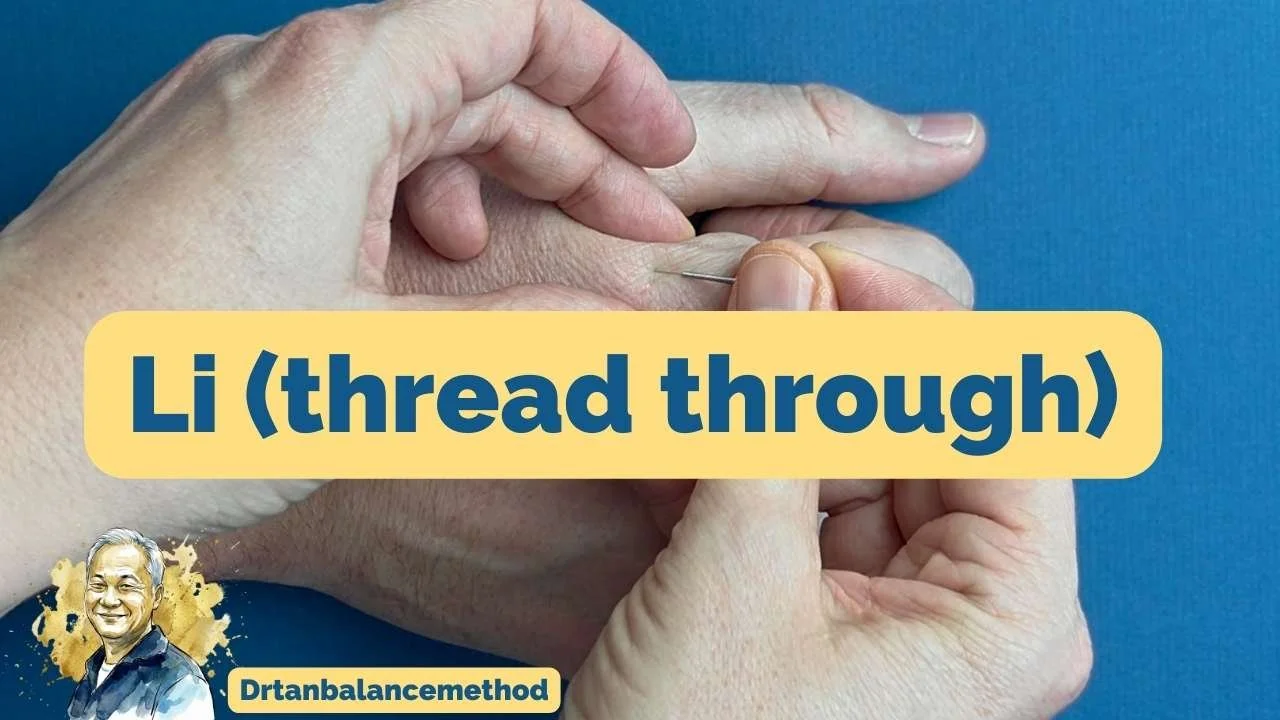 Needling  LI-3 to LI-4,5 (Large Intestine): Balance Method Threading Demo