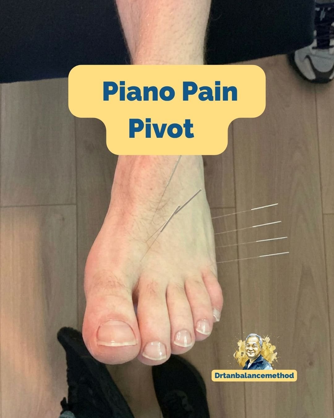 How to Treat Hand Pain with Dr. Tan's Balance Method: A Clinical Case Study