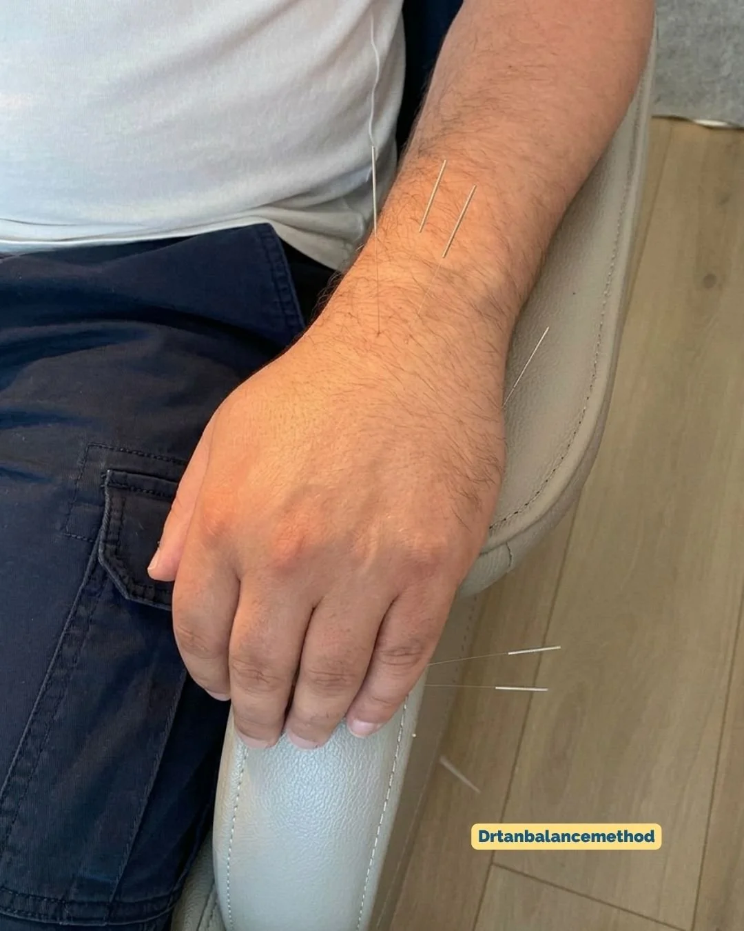 balance-method-wrist-forearm-pain-needling-2.jpg