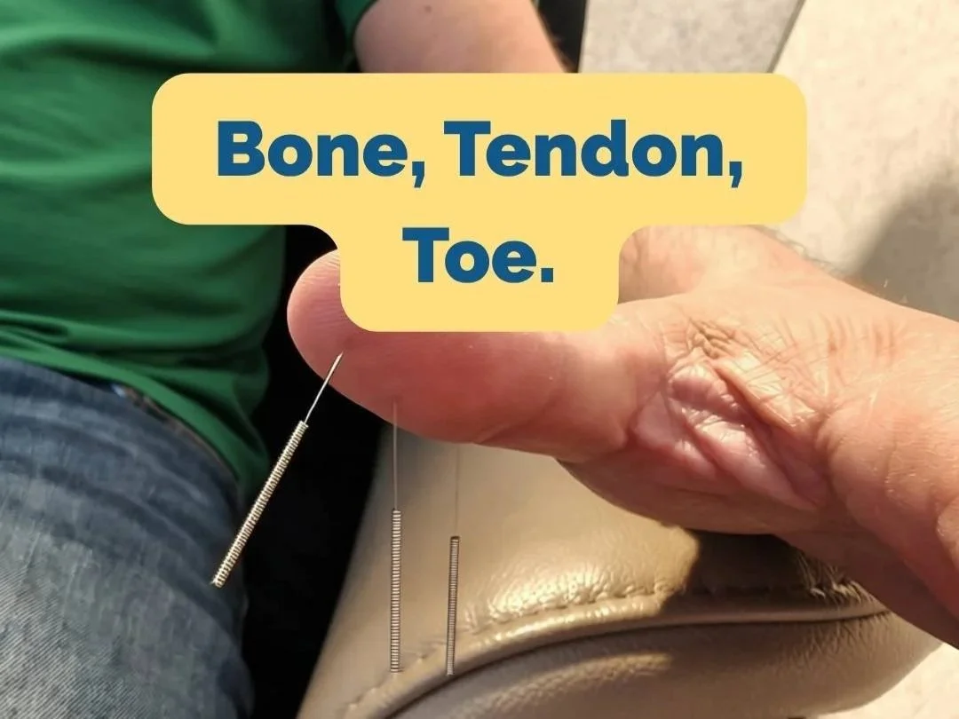 How to Treat Foot Pain and Big Toe Numbness with Dr. Tan's Balance Method: A Local Balance Case Study
