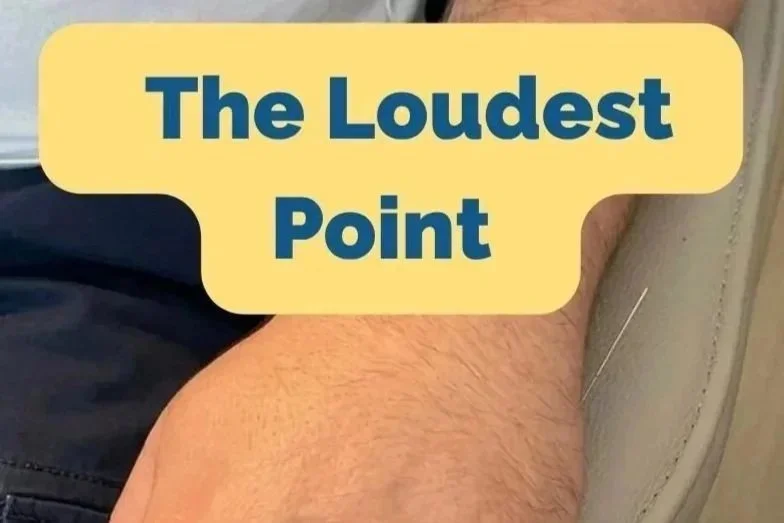 How to Treat Wrist and Forearm Pain with Dr. Tan's Balance Method: A Local Balance Case Study