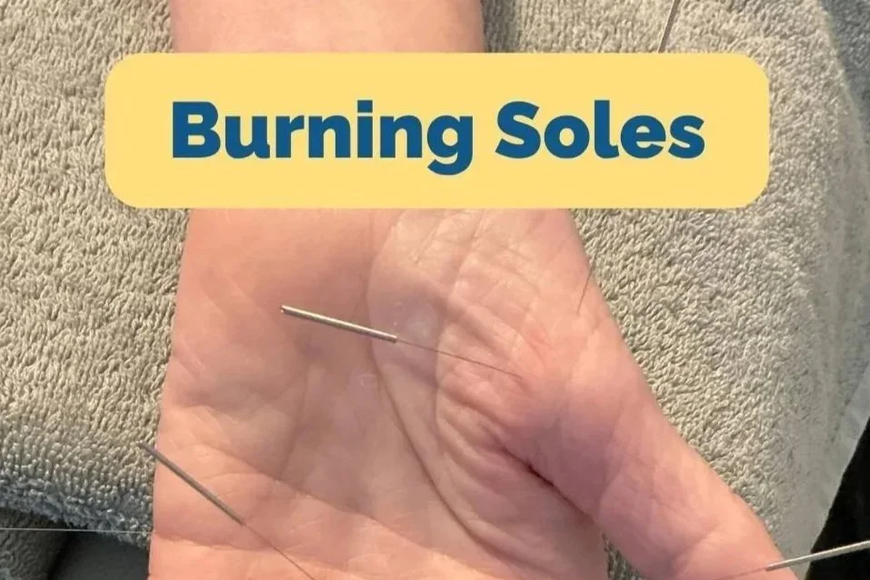 How to Treat Burning Foot Pain with Dr. Tan's Balance Method: A Meridian Line Case Study