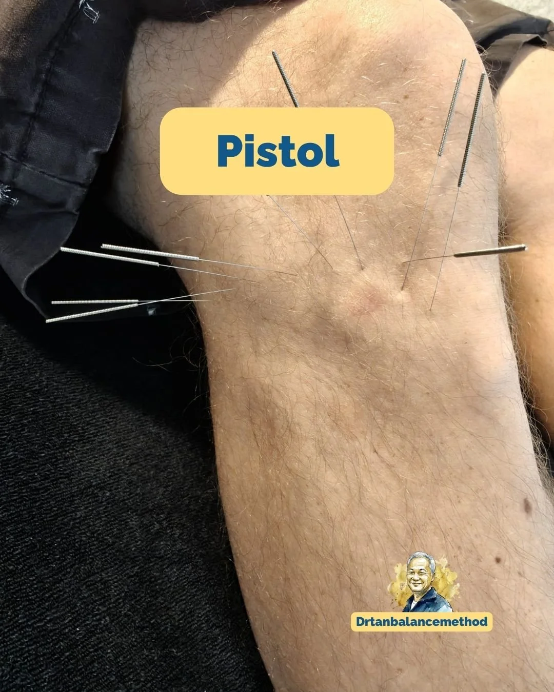 balance-method-knee-pain-squats.jpg