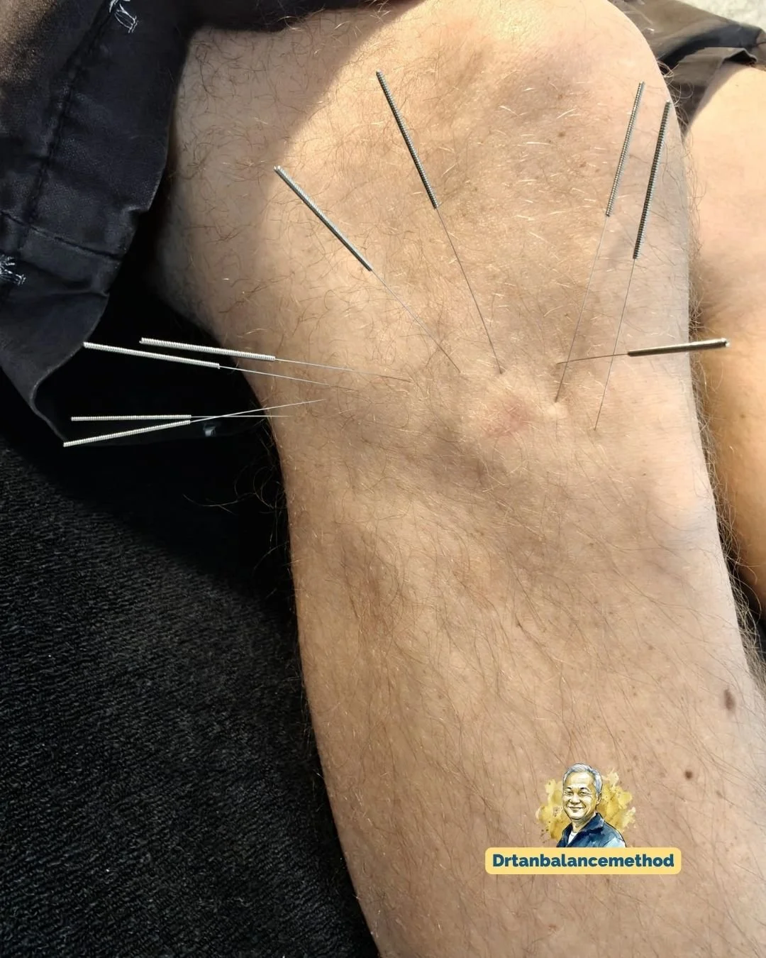 balance-method-knee-pain-squats1.jpg