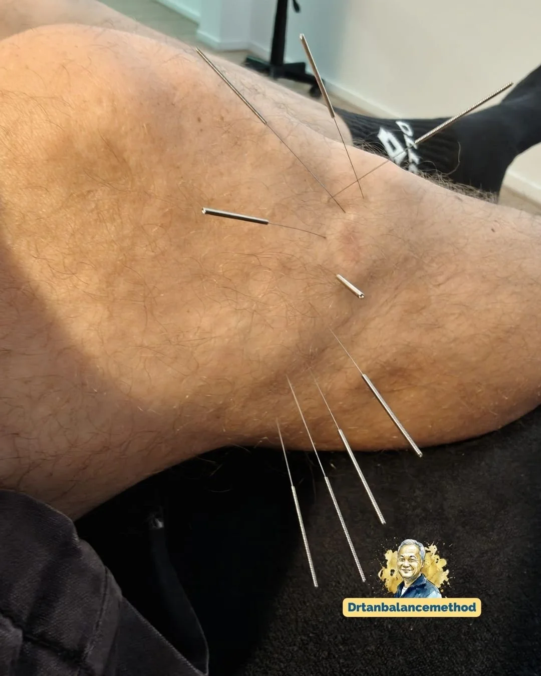 balance-method-knee-pain-squats3.jpg