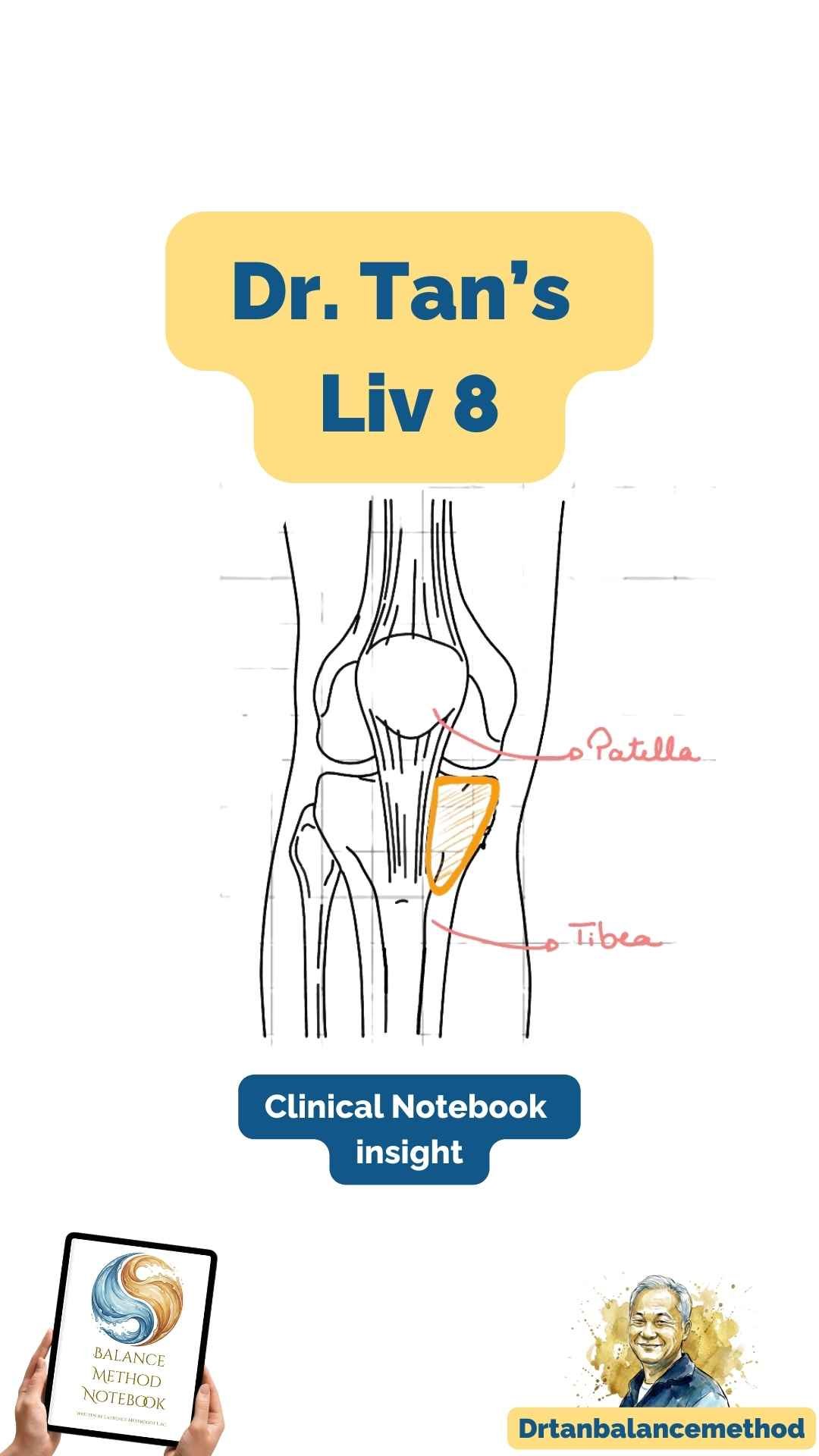 5 Liv8 3 needles.jpg