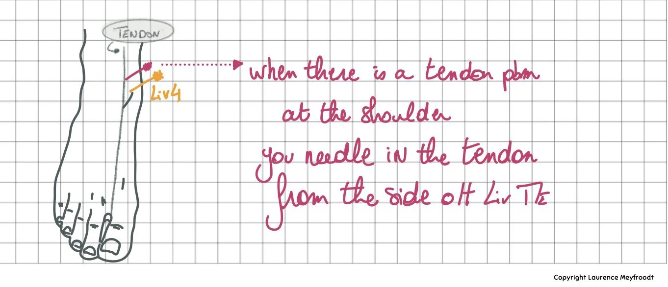 Shoulder treatment dr Tan balance method acupuncture from the Balance method notebook