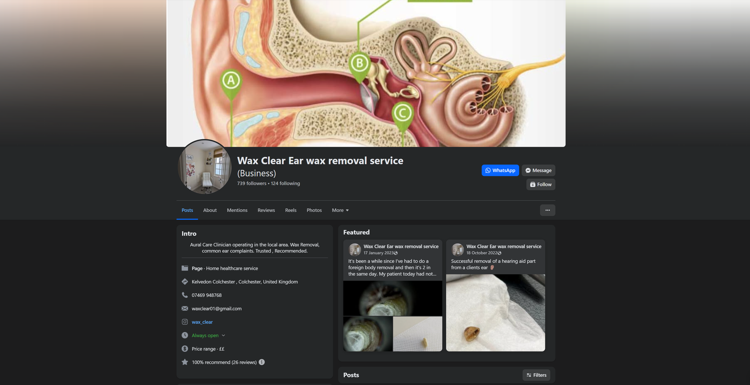 A detailed medical illustration of the human ear anatomy showing the outer, middle, and inner ear with labels.