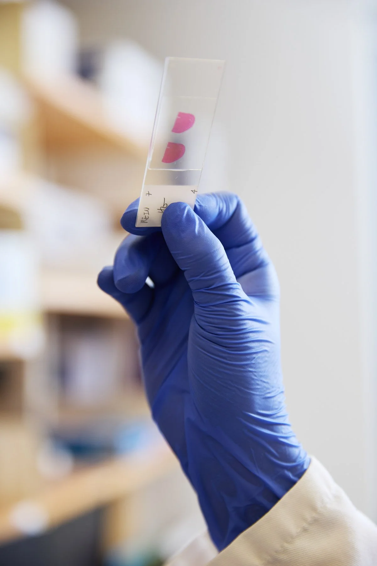 A gloved hand holds a test slide with two pink pills inside a transparent container. At Mount Sinai hospital in New York City