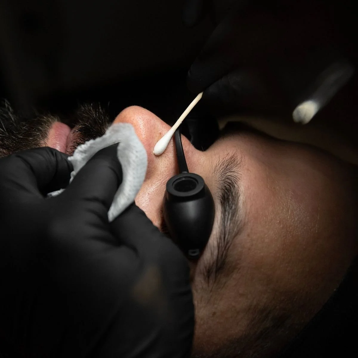 Close-up of a person receiving a dental cleaning, with a gloved hand using a dental instrument to clean the person's teeth.