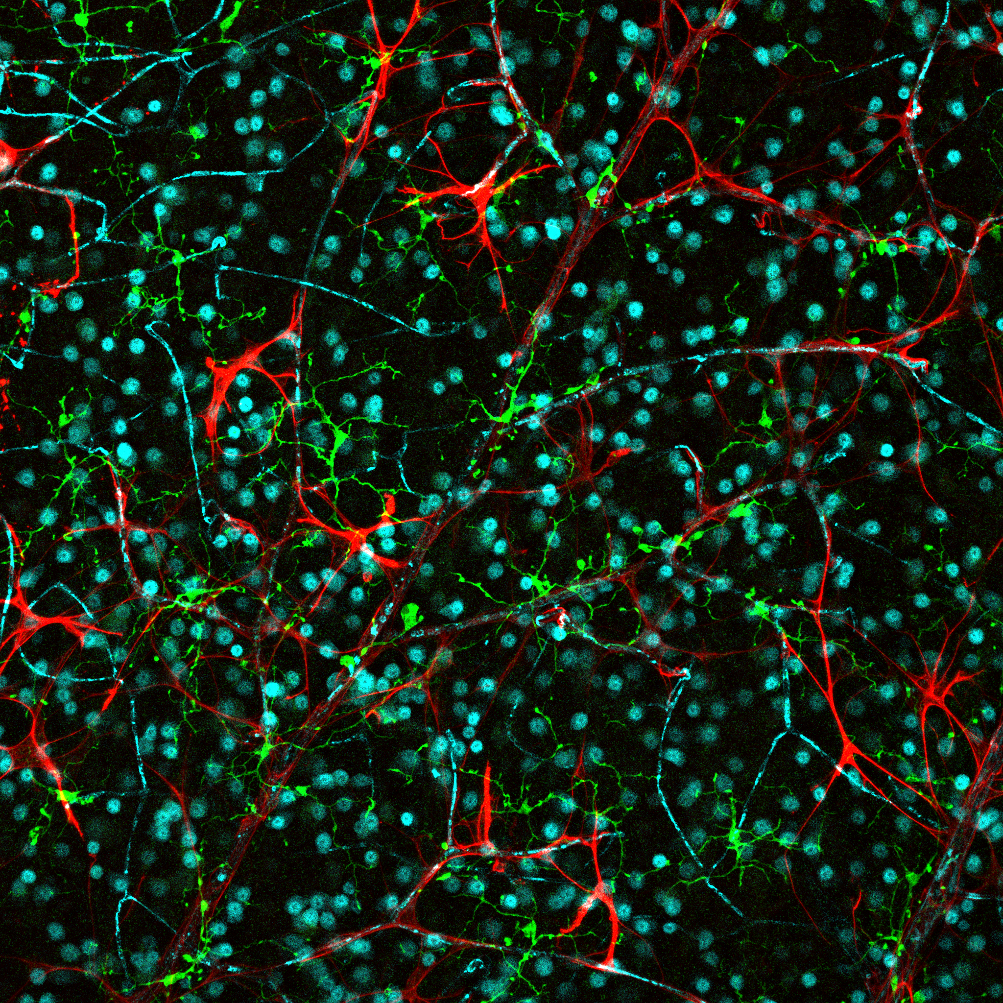 Microscopic view of neurons with colored stained structures, showing red, green, and blue neuron connections and scattered blue cell nuclei on a black background.