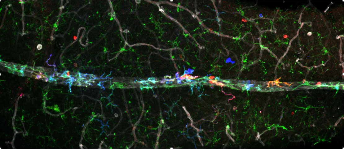 Microscopic view of neural networks with nerve fibers highlighted in green, red, blue, and white on a black background.