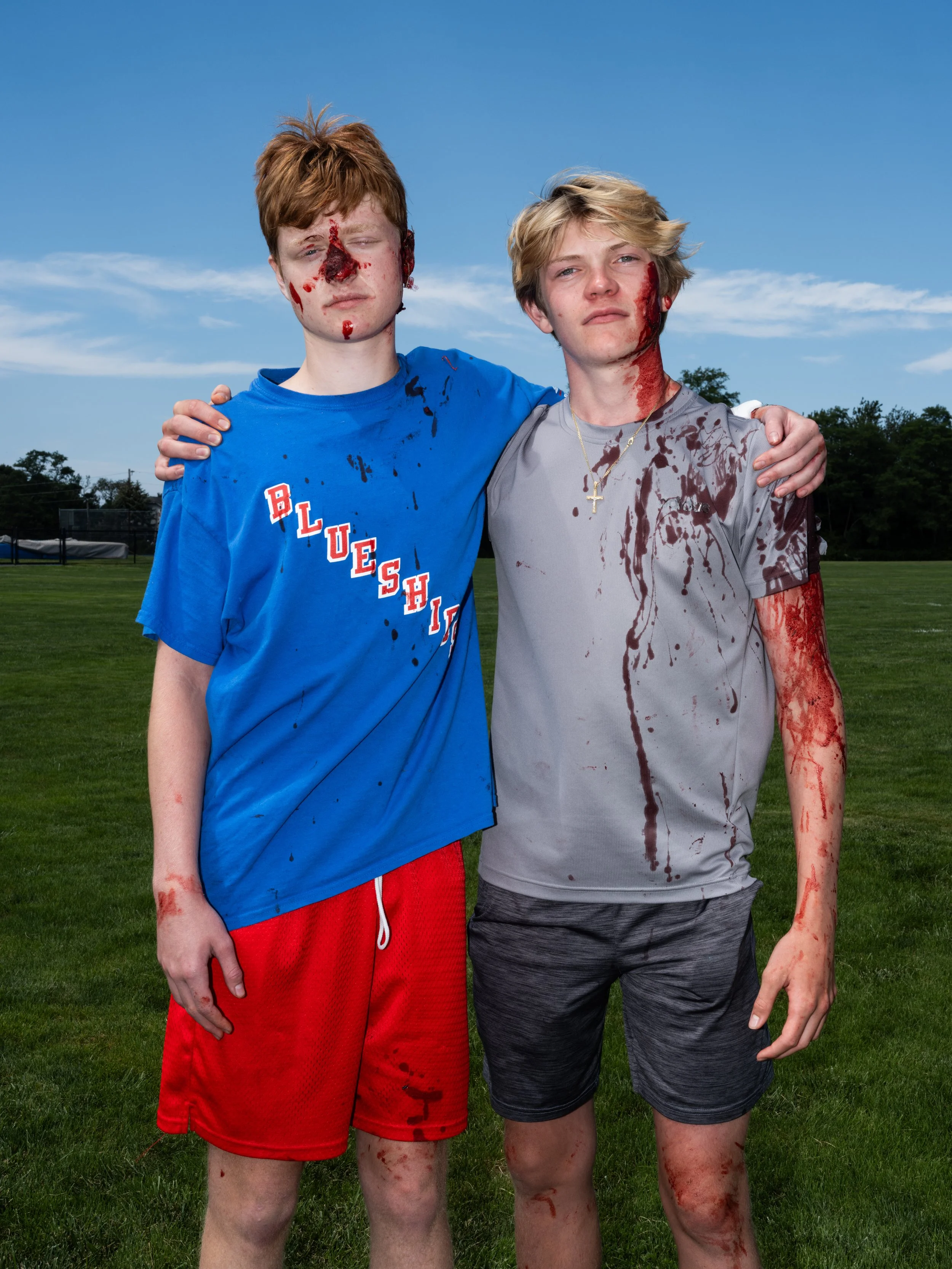 Two teenagers with fake blood and makeup, dressed like zombies, standing outdoors on a field with trees and a blue sky in the background.  An image from the documentary Thoughts & Prayers