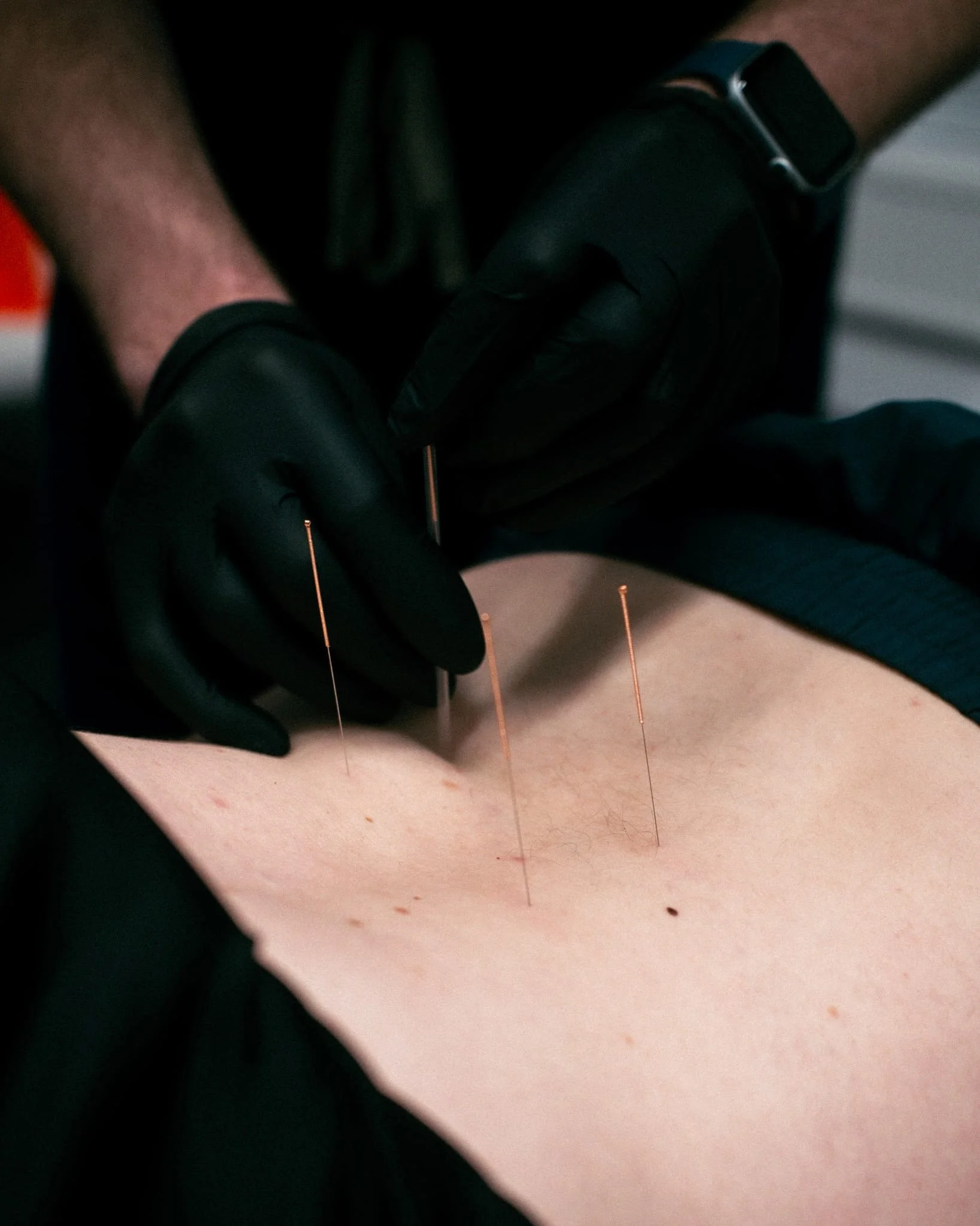 Injury Assessment/Management