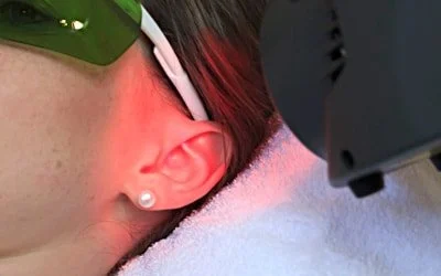 Close-up of a person's ear with an earring, lying on a white towel near a medical or dental device, wearing green glasses.