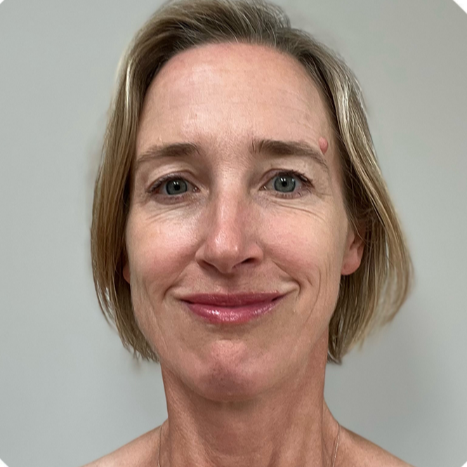 Willemien Schurer, bold strong woman.  smiling face, short blonde hair