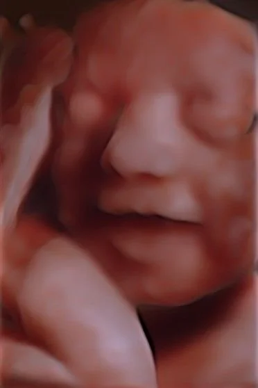 3D ultrasound moment