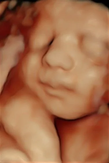 3D ultrasound moment