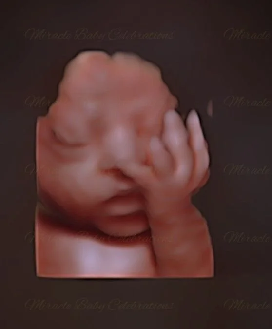 3D ultrasound moment