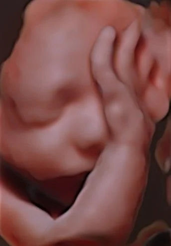 3D ultrasound moment