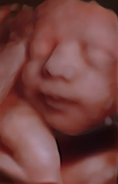 3D ultrasound moment