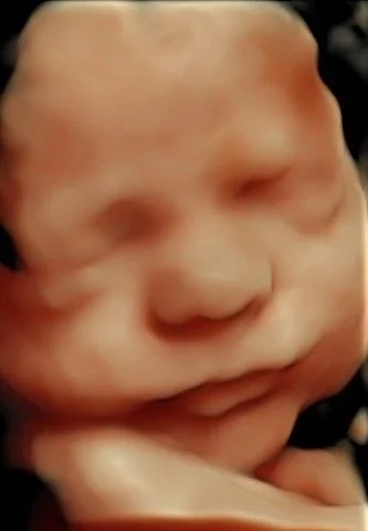 3D ultrasound moment
