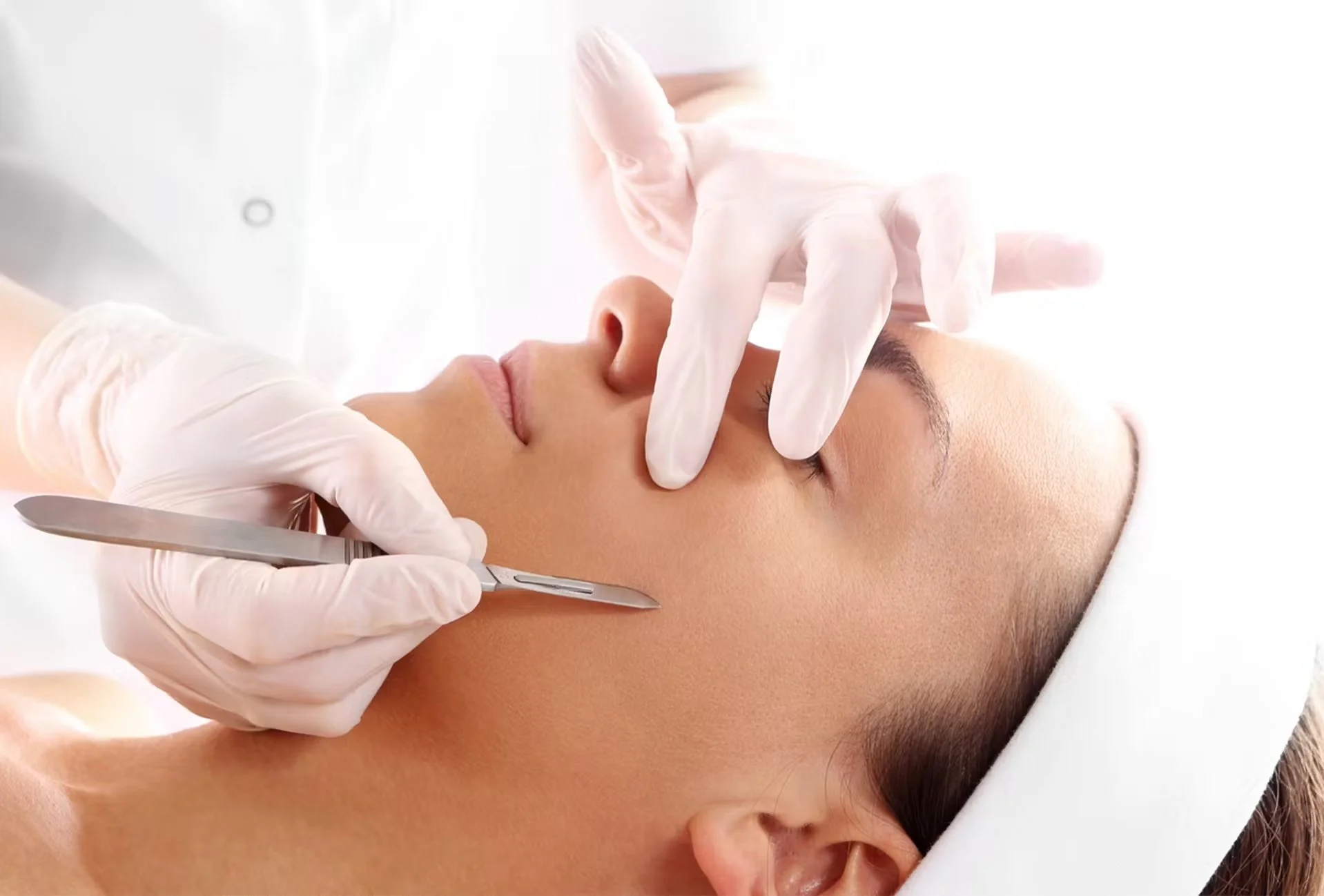 dermaplaning toronto