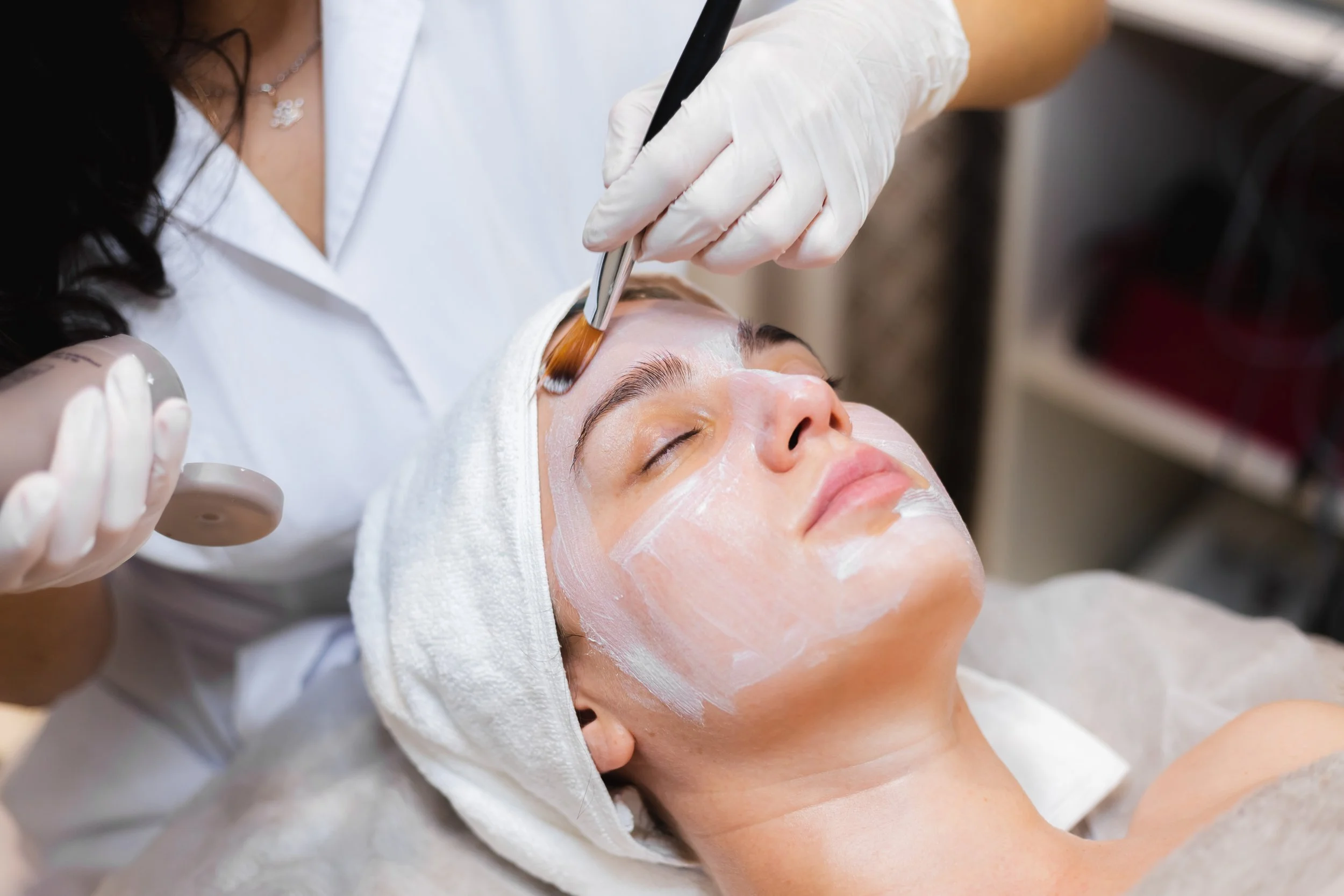 Chemical Peels in Toronto: Benefits, Downtime &amp; What to Expect
