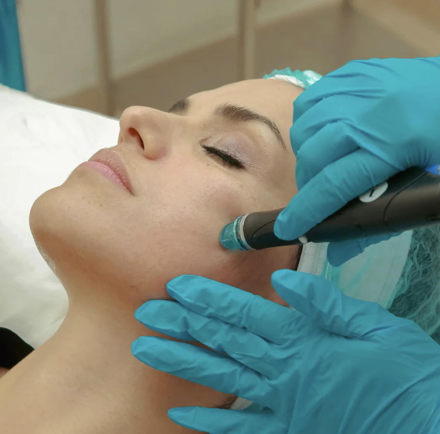 Microneedling