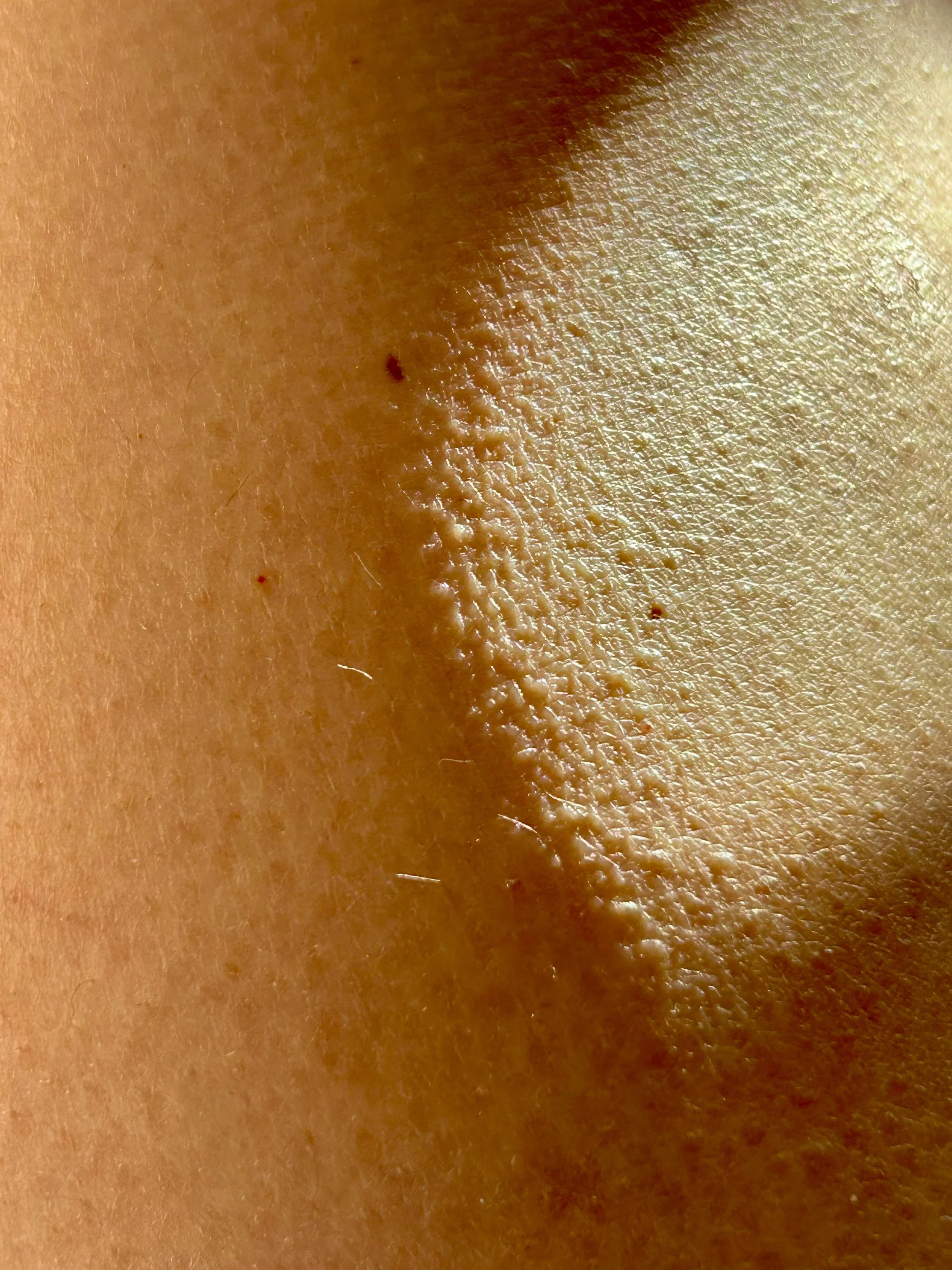 Close-up of human skin with visible pores, small moles, and fine hair.
