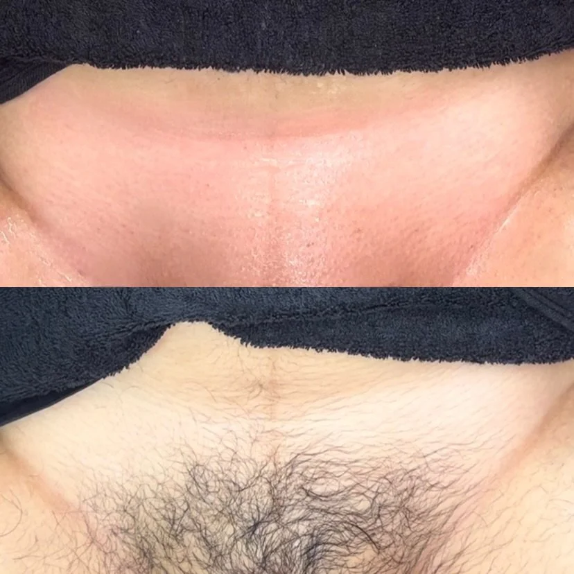 Brazilian Wax