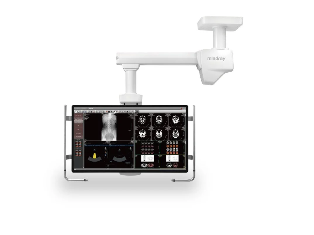 Medical imaging equipment with a screen displaying various scans, including an X-ray of a full body and CT scans, mounted on an adjustable arm labeled 'mindray.'