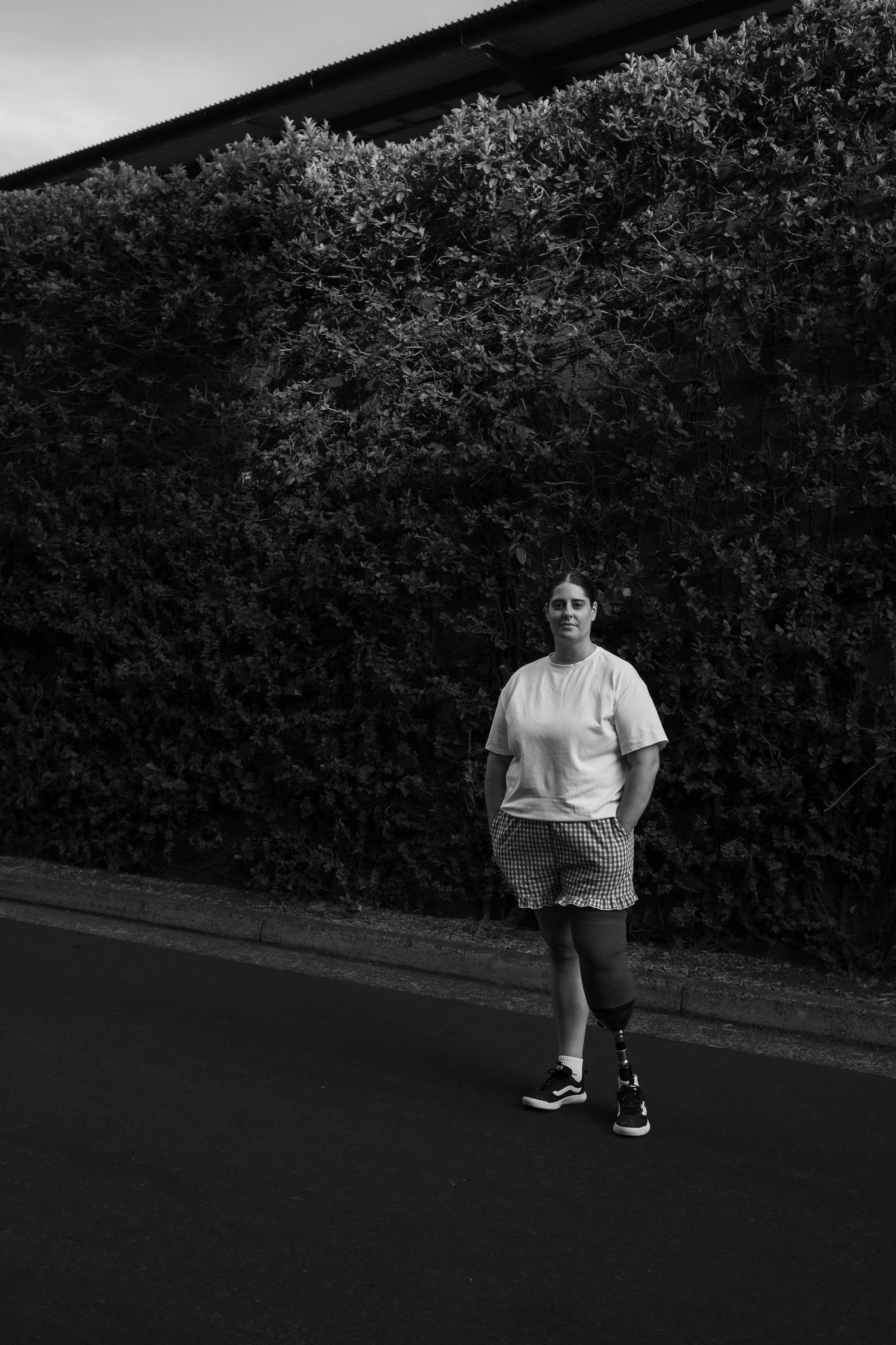 A woman stands on a street with her hands in her pockets, one leg prosthetic, in front of a large hedge. The photo is in black and white.