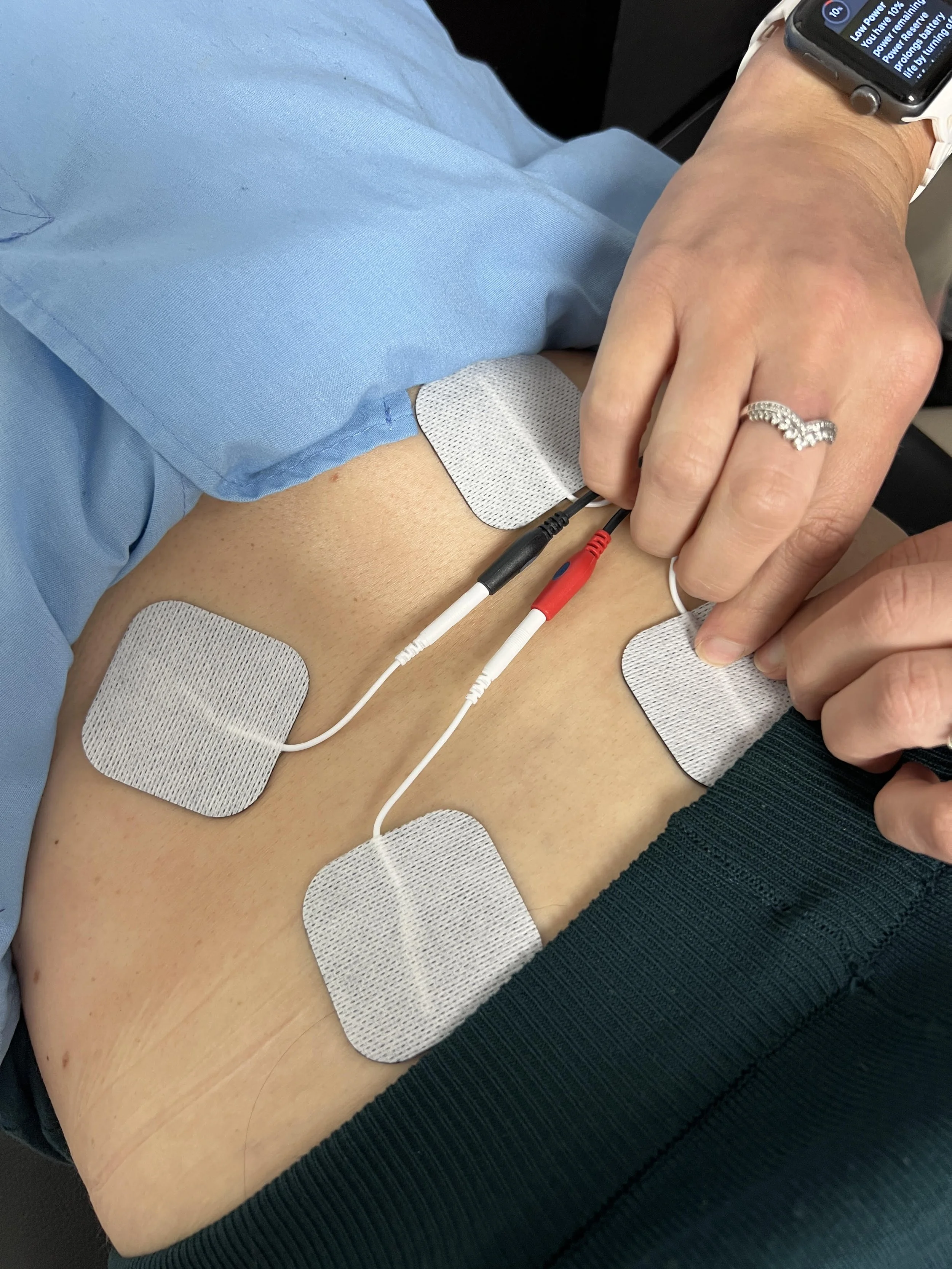 Person receiving an electrocardiogram (ECG or EKG) with electrodes attached to their chest.