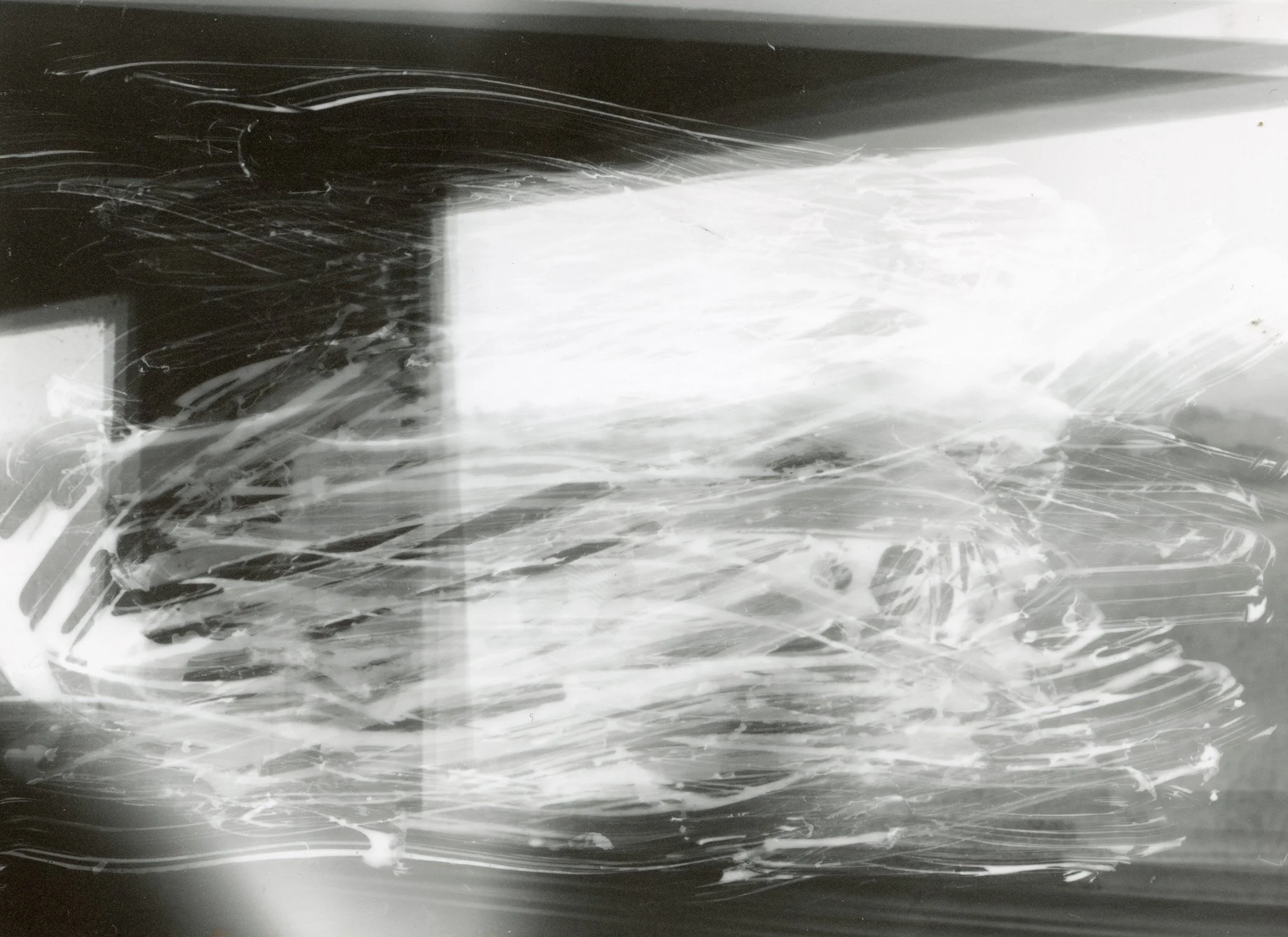 Rayons X montrant une fracture de l'os du bras.