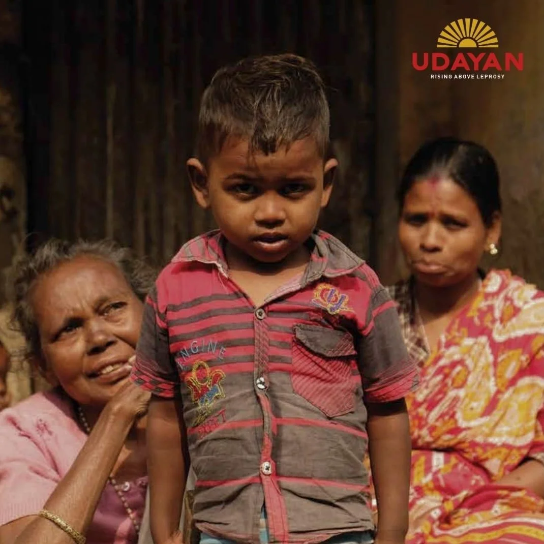 A young boy with a serious expression standing between two women, one elderly and one middle-aged, in a rural setting with a wooden background, promoting a leprosy awareness campaign by Udayan Kolkata.