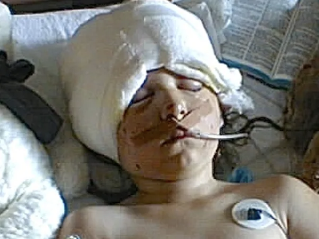 Raquel-in-hospital-in-a-coma-tubes-bandages