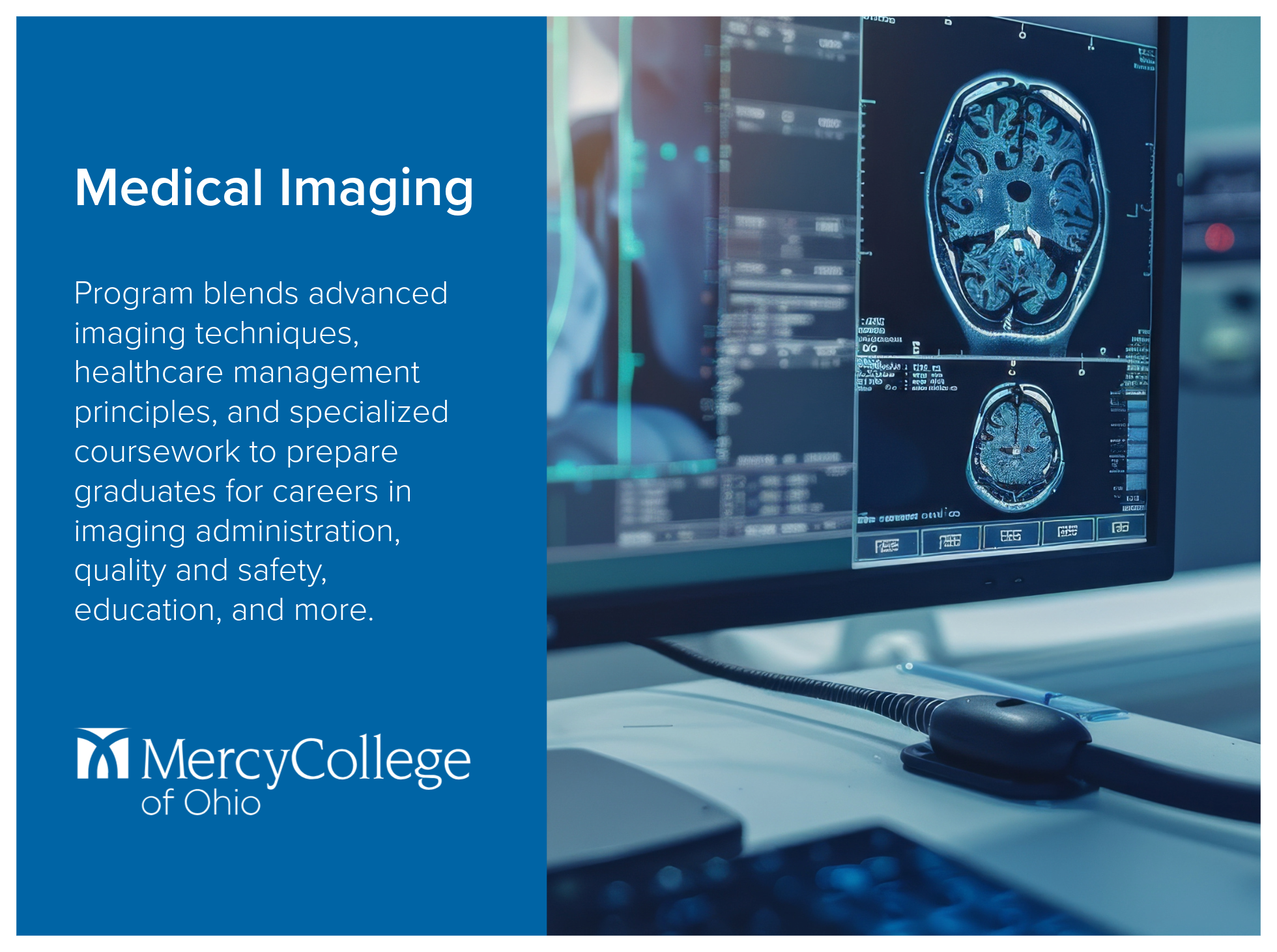 Medical Imaging program at Mercy College of Ohio blends advanced imaging techniques, healthcare management principles, and specialized coursework to prepare graduates for careers in imaging administration, quality and safety, education, and more. Ima
