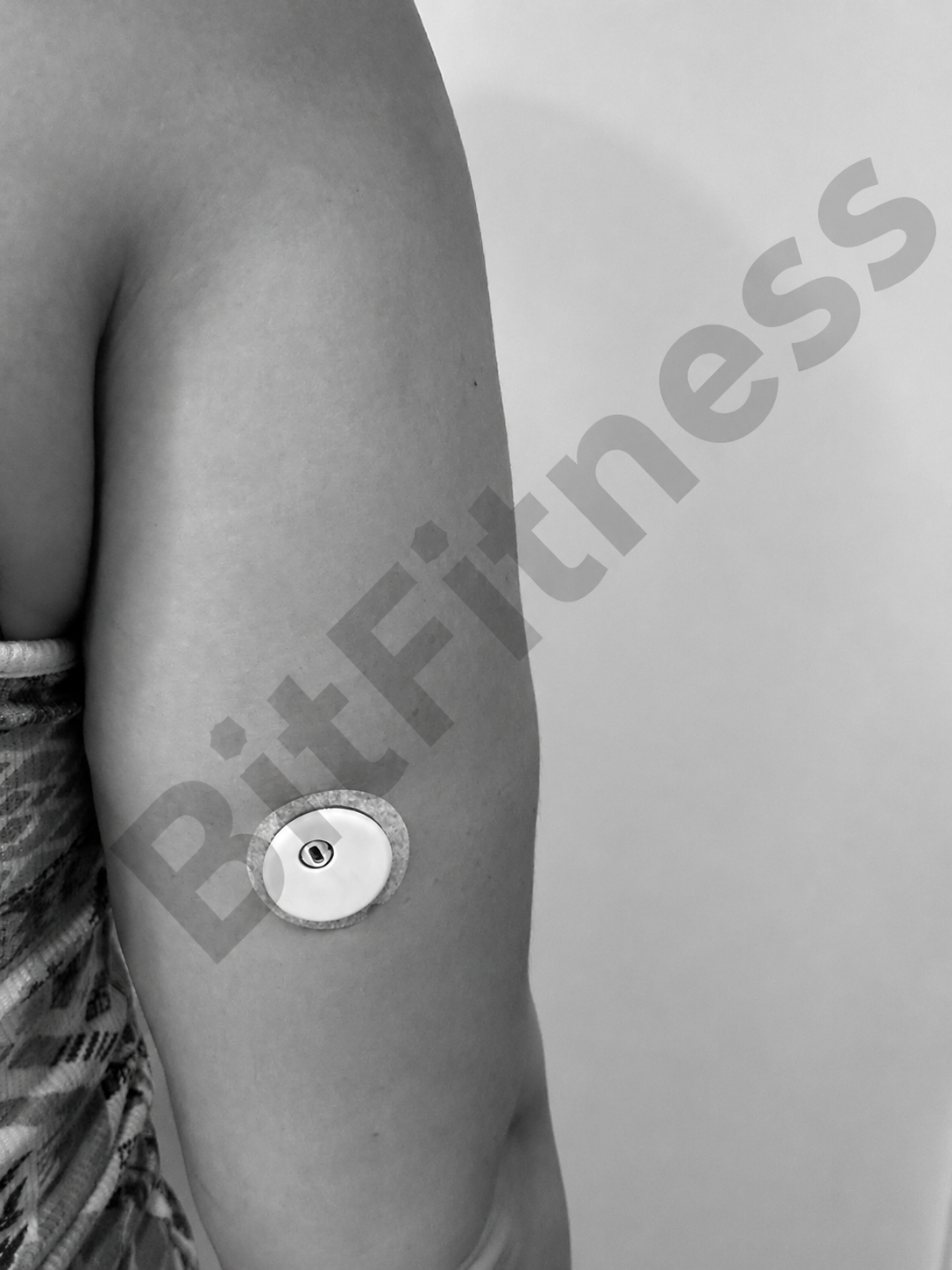 Close-up of a person's upper arm with a medical device attached to the skin.