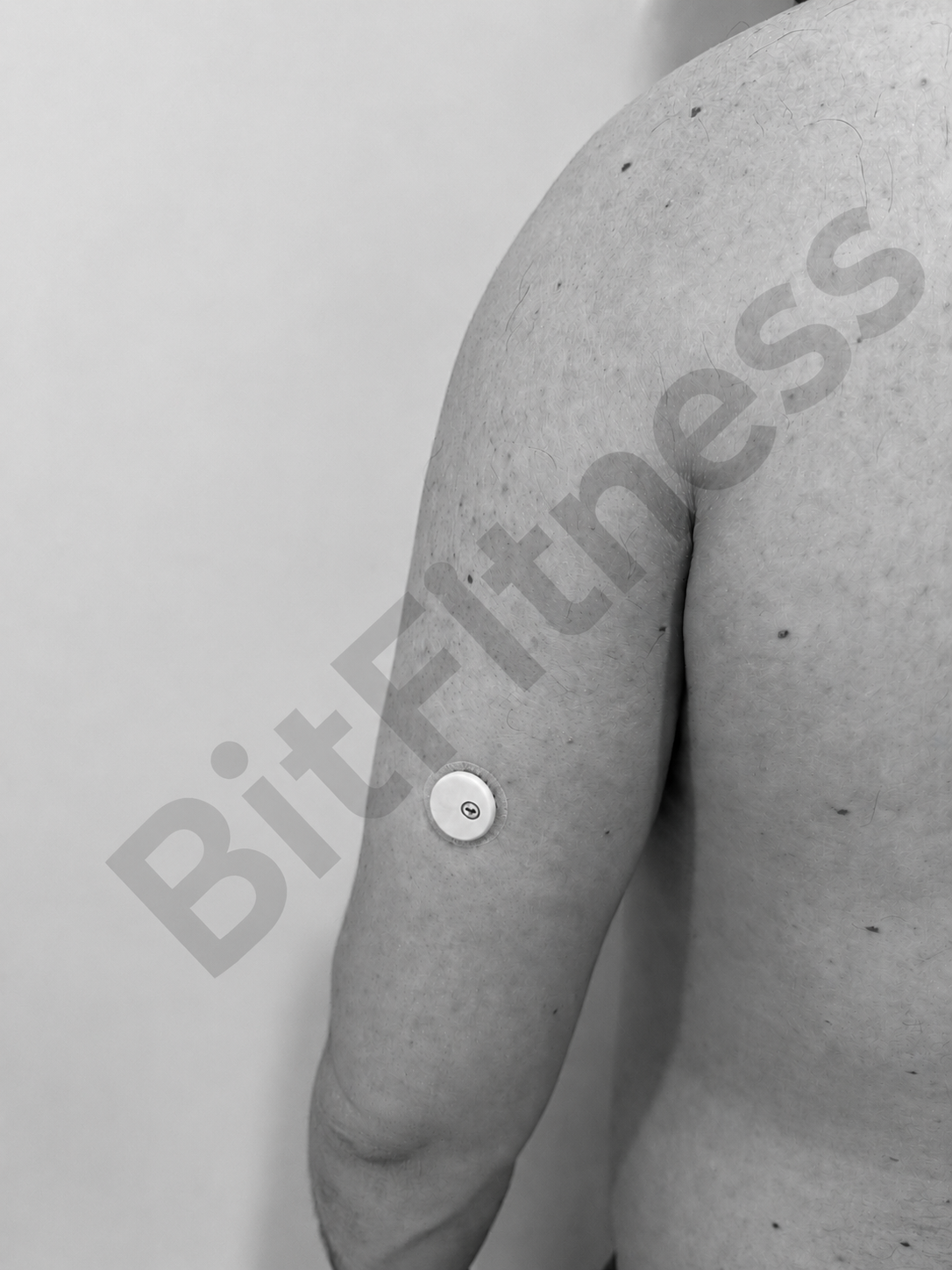 Close-up black and white photo of a person's arm with a small circular button attached to the skin.