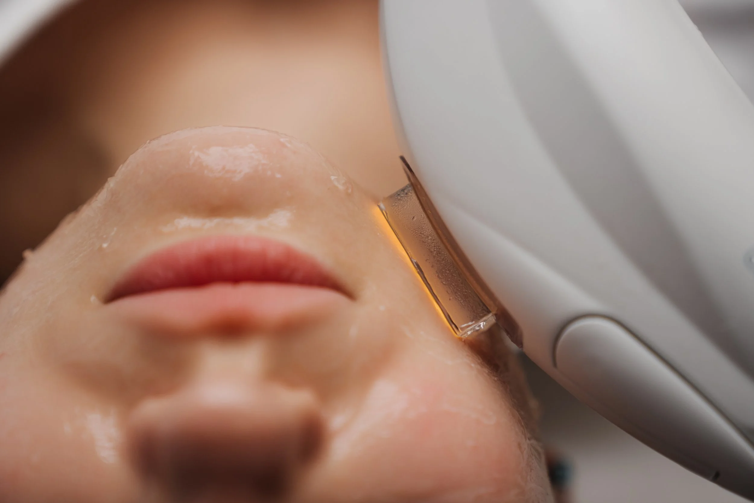 Close-up of a person's face during a facial or skincare treatment with a white device emitting light near their cheek.