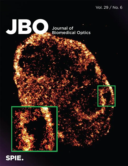 Biomedical Optics, vol. 29 / No. 6