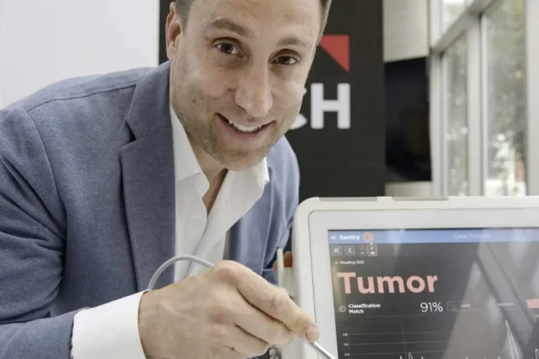 Le cancer mieux traité grâce à une sonde d’ici