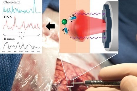 New laser probe identifies brain cancer cells in real time