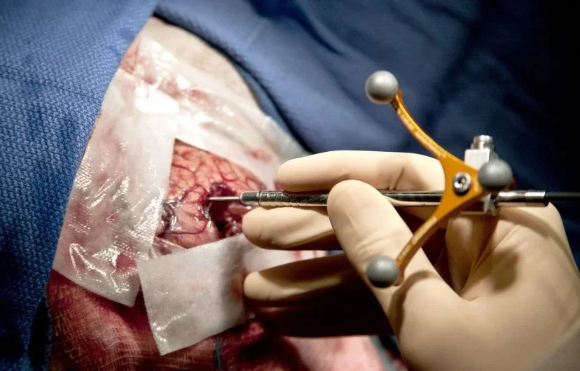 hand-held Raman spectroscopic probe technique